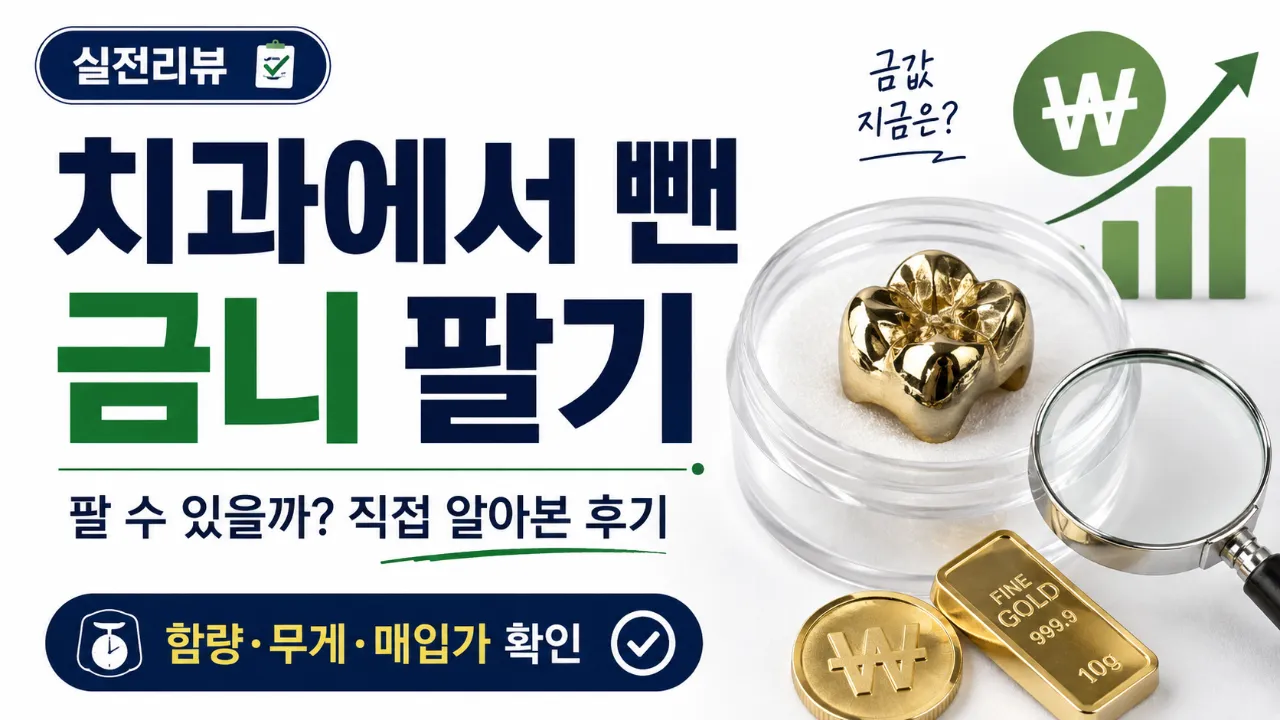 금니 팔기 임플란트-가격비교-후-오른쪽-어금니-발치-후기